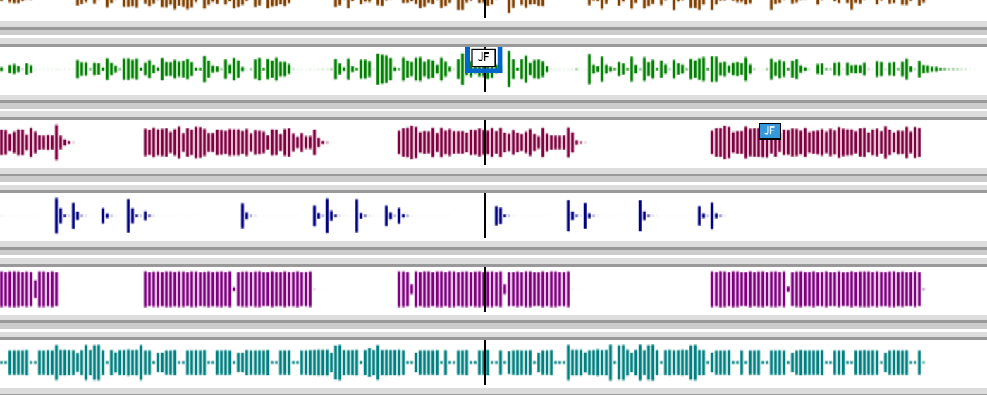 Comment markers on waveform